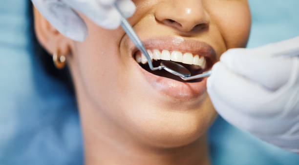 Best Emergency Dental Care for Broken or Chipped Teeth in Girardville, PA