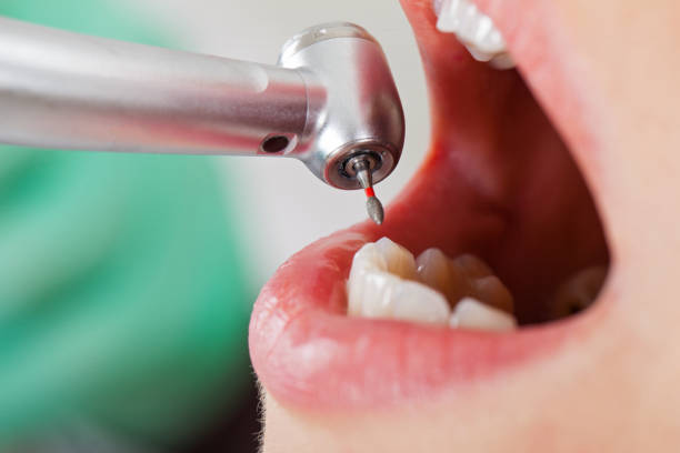 Best Emergency Dental Care for Broken or Chipped Teeth in Girardville, PA